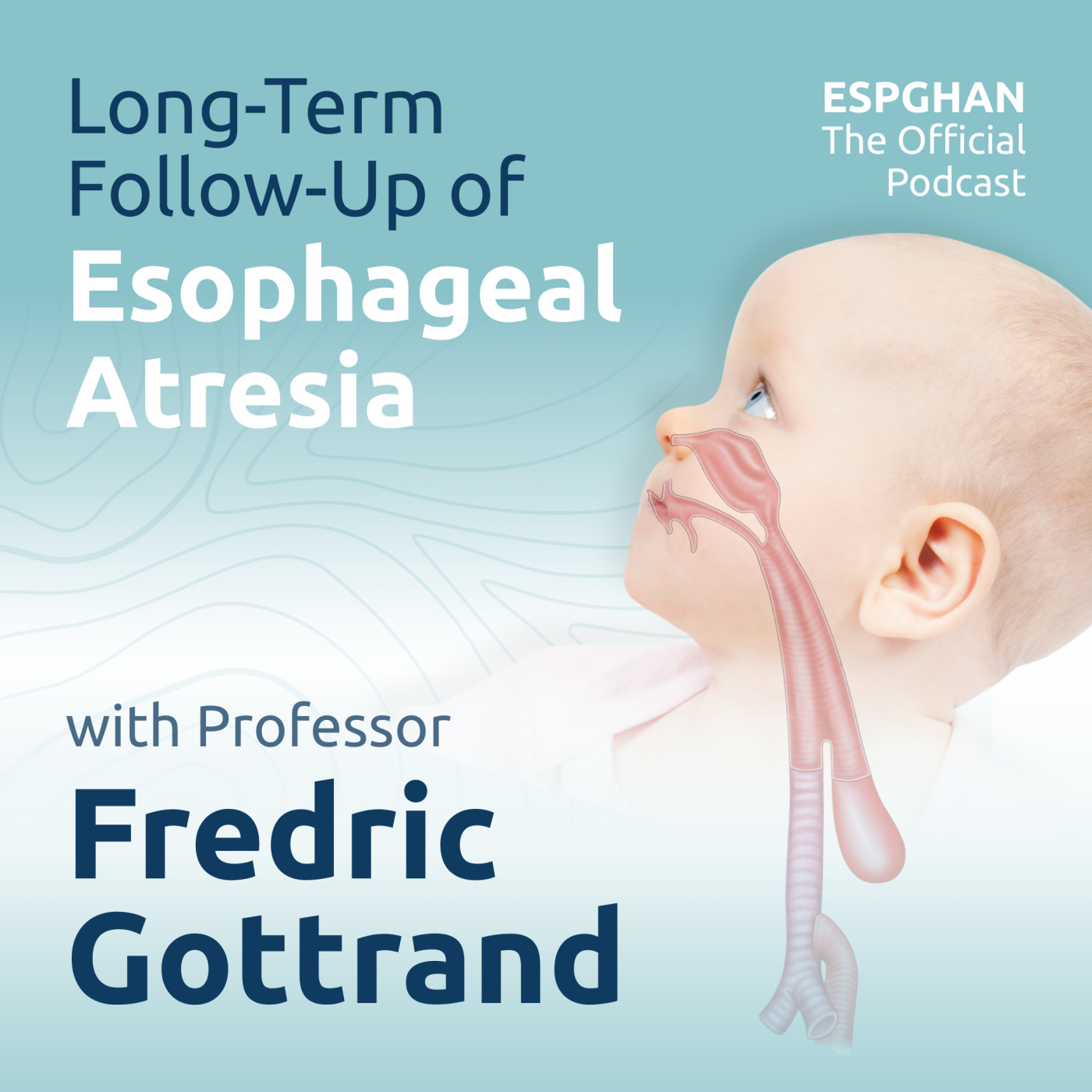 Gottrand F.: Long-Term Follow-Up of Esophageal Atresia
